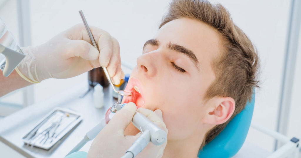 root canal