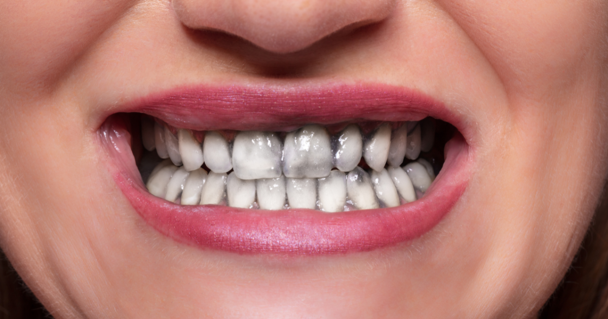 Is charcoal toothpaste safe?